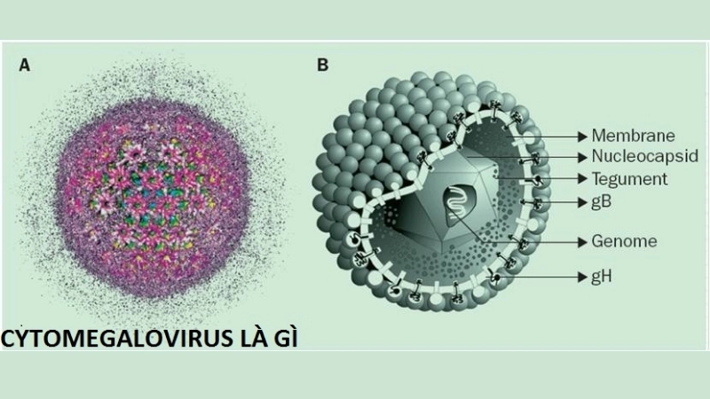 Cytomegalovirus (CMV) Infection cmv mononucleosis