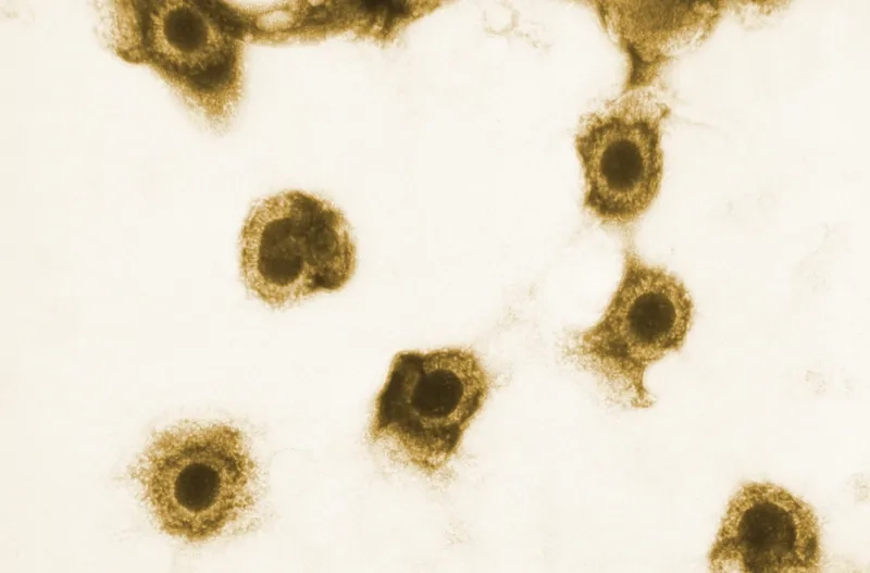 A microscopic view explaining what is cytomegalovirus