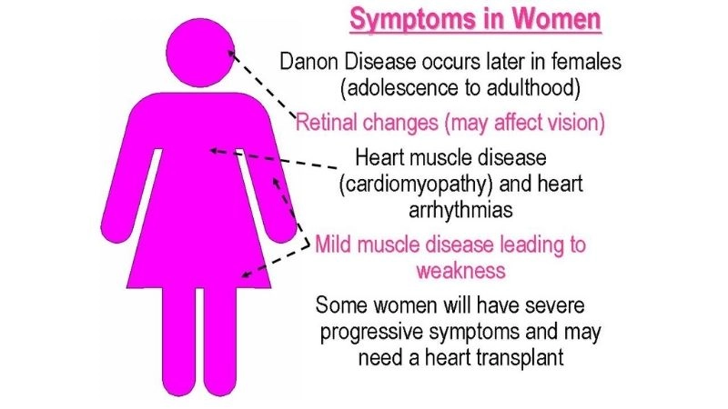 Danon disease in females unique symptoms and challenges