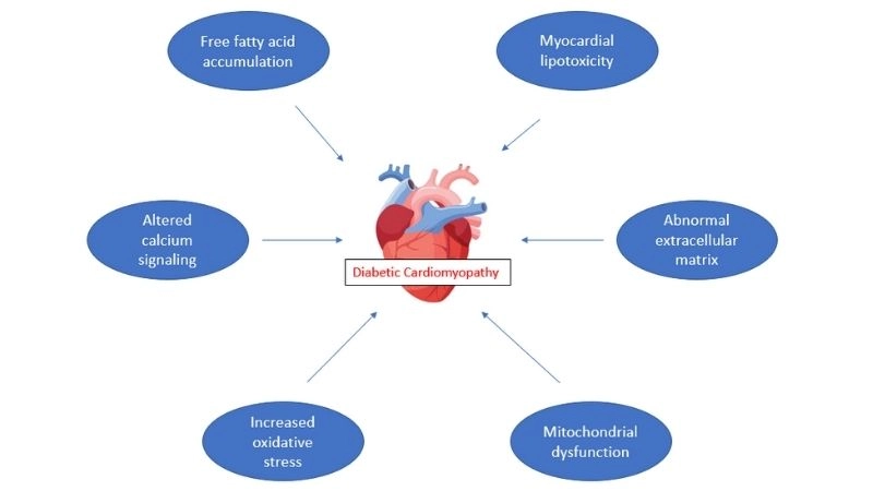 Diabetic cardiomyopathy symptoms warning signs in diabetic hearts