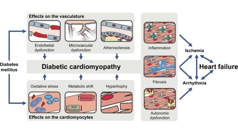 Diabetic cardiomyopathy risk factors factors increasing heart problems