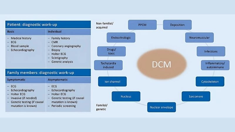 Peripartum cardiomyopathy develops late in pregnancy or postpartum