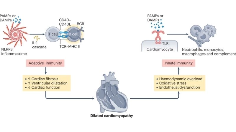 Genetic testing for cardiomyopathy helps identify inherited risks
