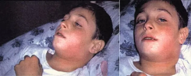 Child getting a diphtheria immunization