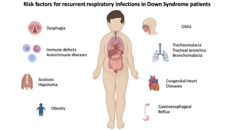 Ventricular septal defect and Down syndrome risk