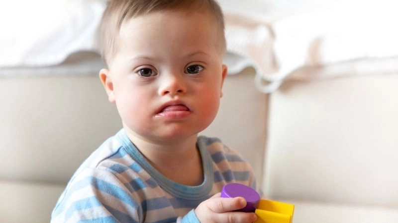 Down syndrome heart surgery and recovery