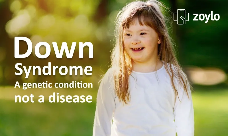 Mosaic down syndrome with unique clinical features