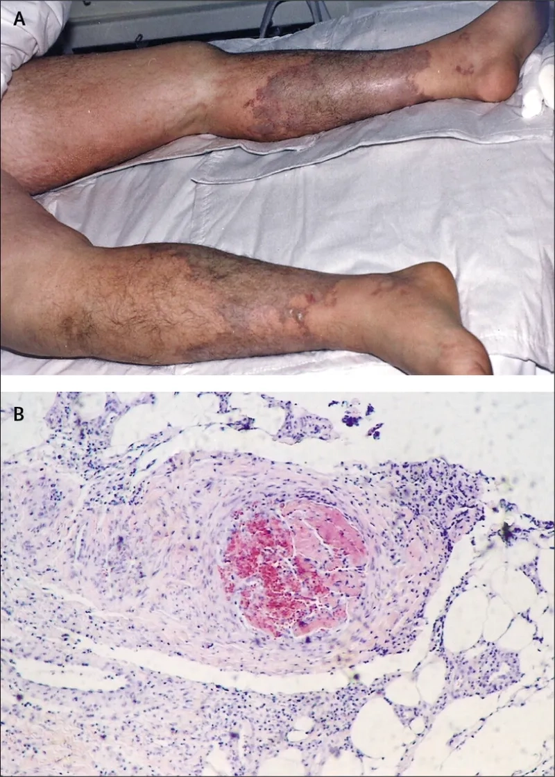 Key steps for the prevention of e coli