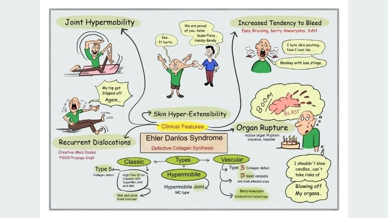 Genetic basis in Ehlers-Danlos syndrome COL3A1 gene