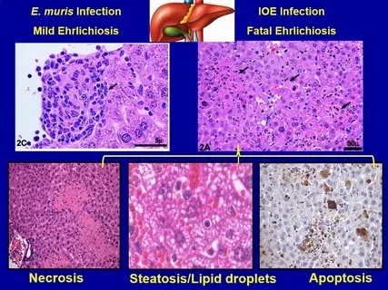 Understanding the long term effects of ehrlichiosis