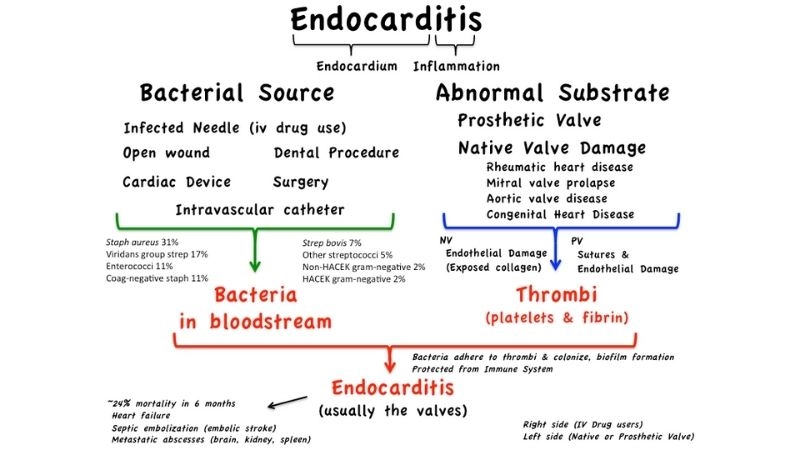 Endocarditis heart murmur often signals valve infection