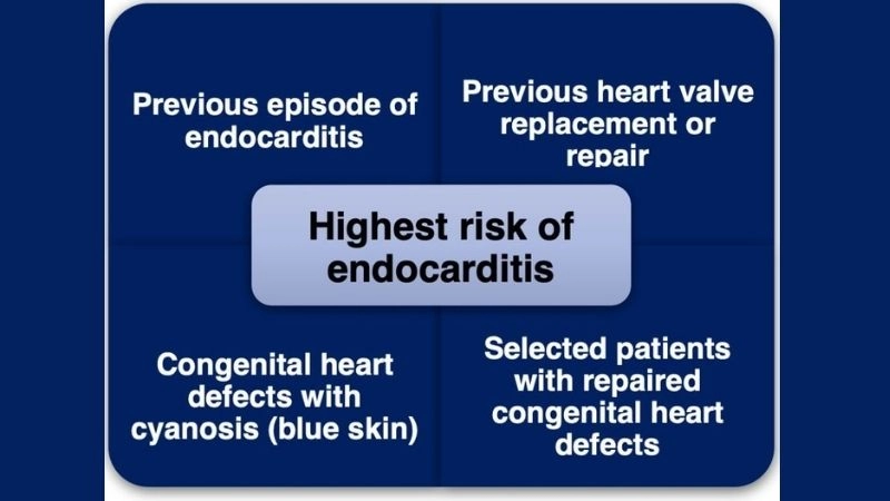 Endocarditis heart valve surgery may be necessary
