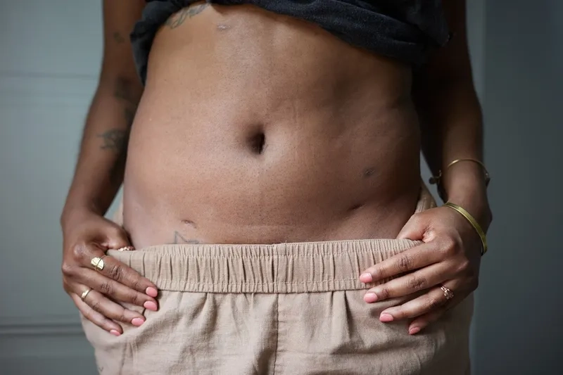 Healthcare professional explaining endometriosis treatment options