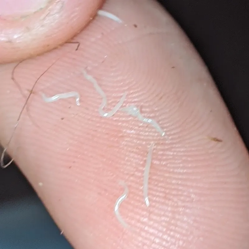 The pinworm test tape method for diagnosis