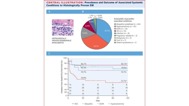 Eosinophilic myocarditis diagnosis accurate methods for detection