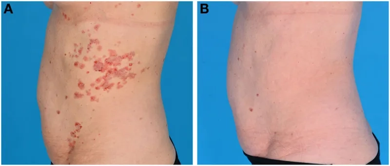 A specialist explaining the EBA diagnosis criteria