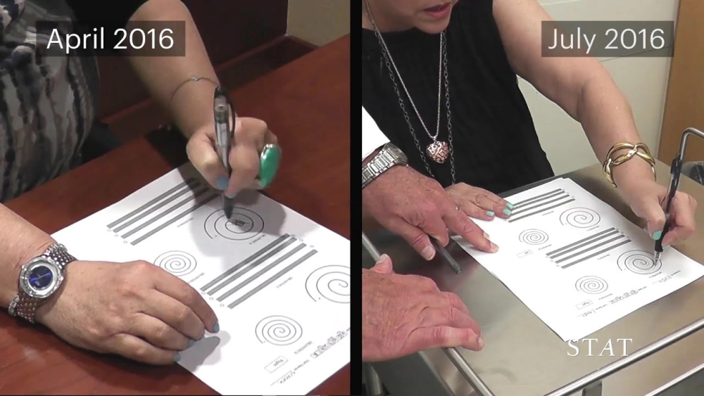 A patient performing a writing test for tremors