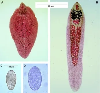 Understanding the Impact of Liver Fluke Disease