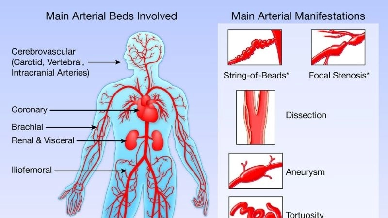 FMD treatment options for better patient outcomes