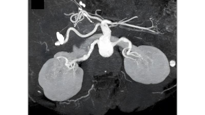 FMD diagnosis using advanced imaging techniques