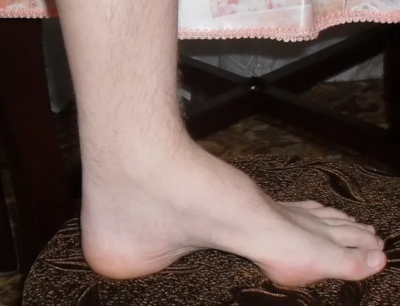 A visual guide to genetic ataxia inheritance