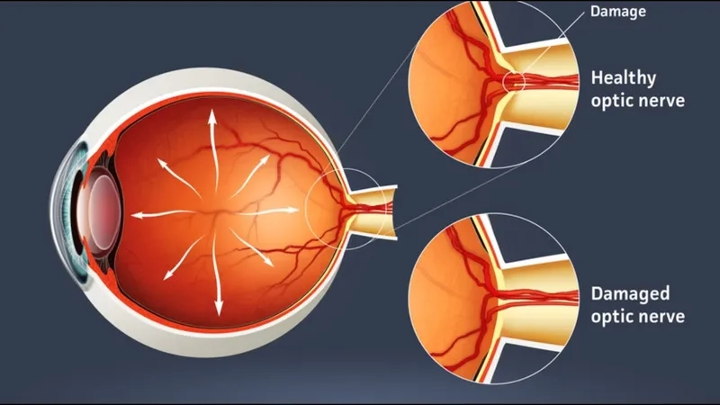 Understanding if glaucoma will make you blind