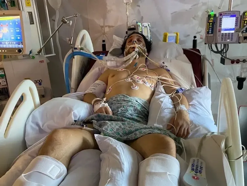 Understanding the main causes of GBS