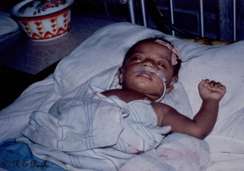 Administering treatment for Haemophilus influenzae