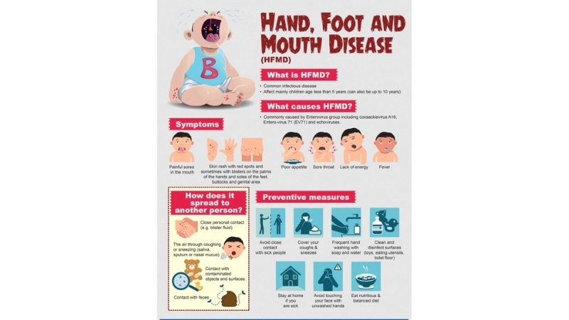  Illustration of what is hand foot and mouth disease