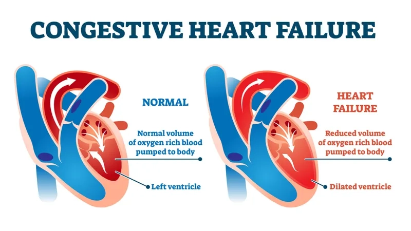Various types of heart failure explained