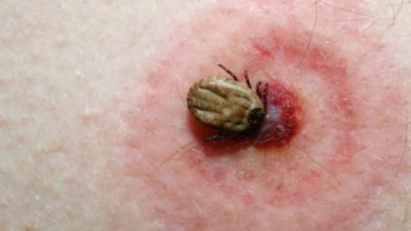 Heartland Virus Disease found in virus geographic range