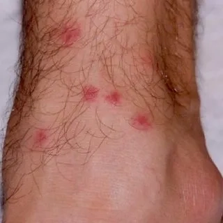 An illustration of different types of helminths