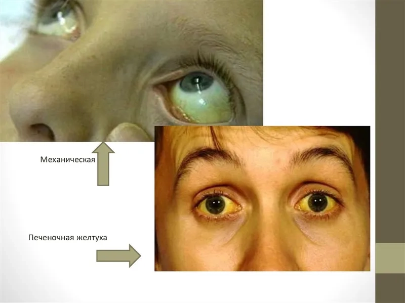 The recommended hepatitis a vaccine schedule for all ages