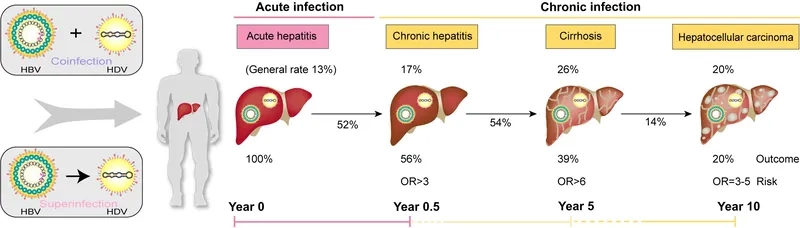 Understanding why is hepatitis d dangerous for the liver