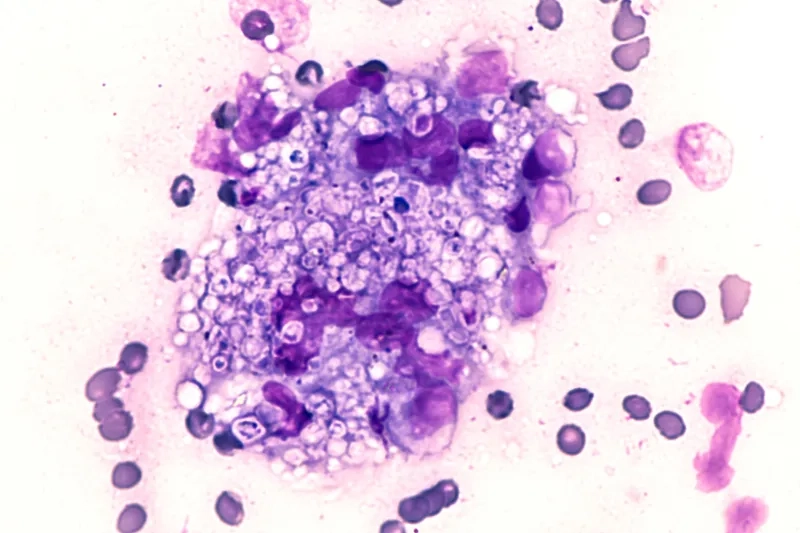 Fungal spores causing histoplasmosis in the air