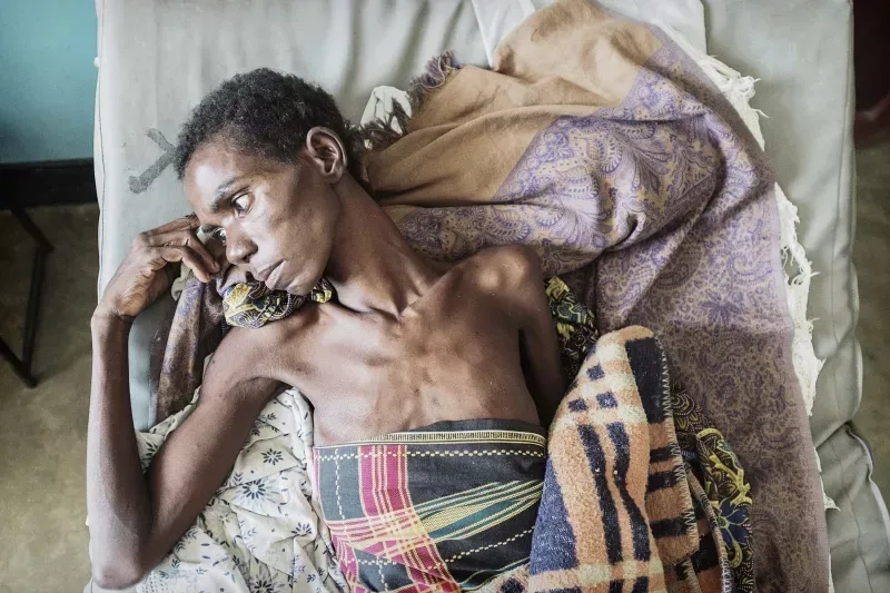 A medical chart displaying common HIV symptoms