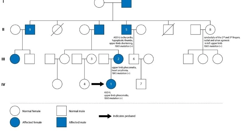 Holt-Oram syndrome genetics and mutations