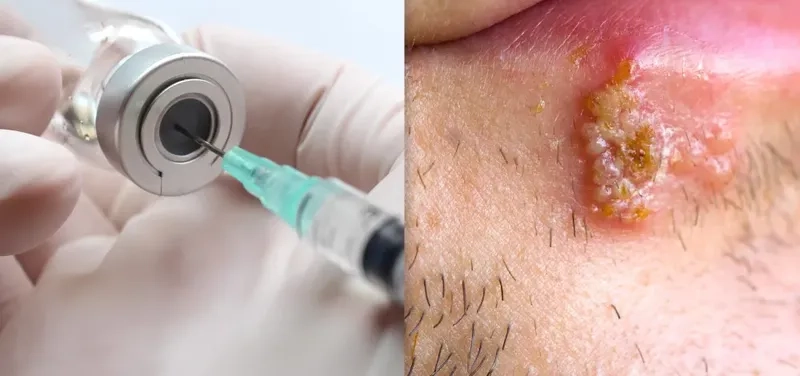 Understanding the cellular effects of high-risk HPV