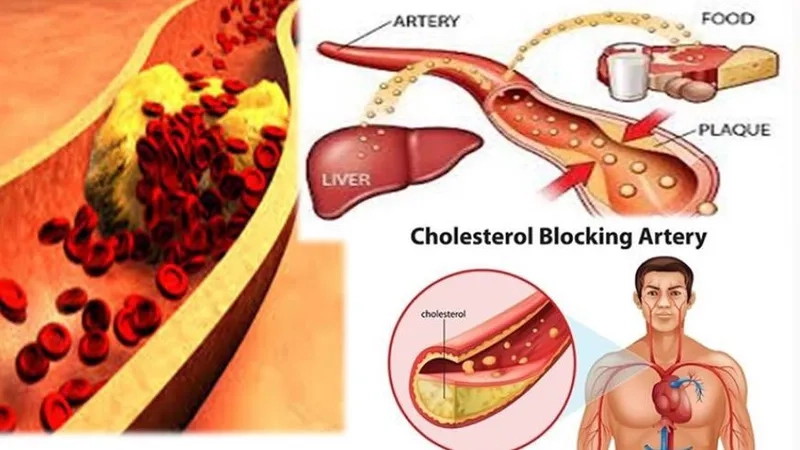 Statins illustrated in prescription medication image