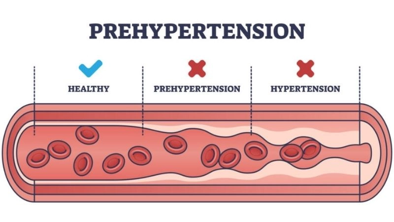 High blood pressure symptoms as silent warnings
