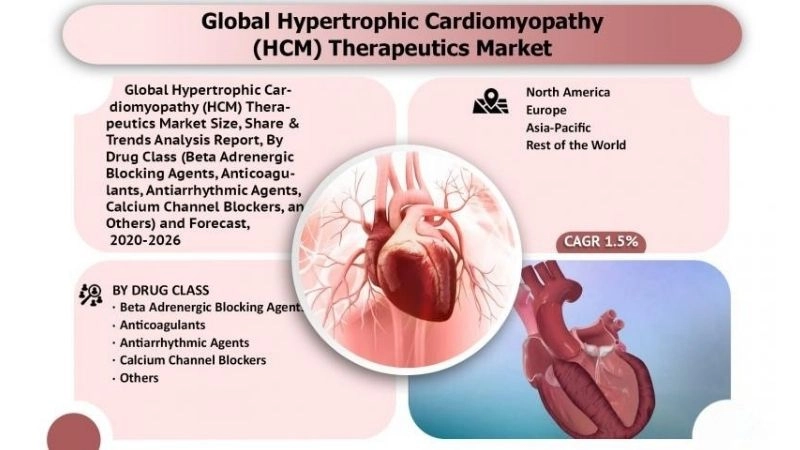 Nonobstructive hypertrophic cardiomyopathy thickens heart muscle