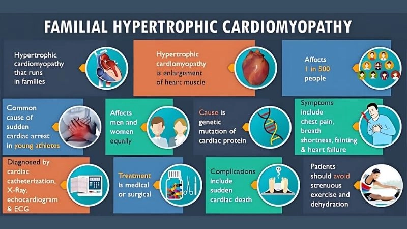 Mavacamten hypertrophic cardiomyopathy drug reduces obstruction