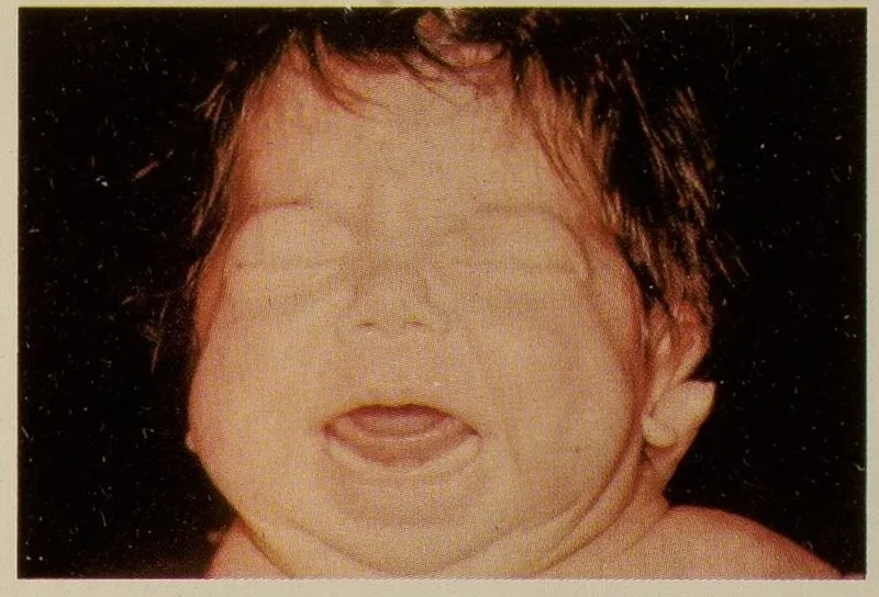 Prescription bottle of levothyroxine on a pharmacy counter