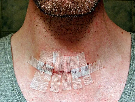 Technician preparing thyroid function test equipment