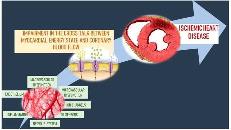 Causes of ischemic cardiomyopathy stem from blocked arteries