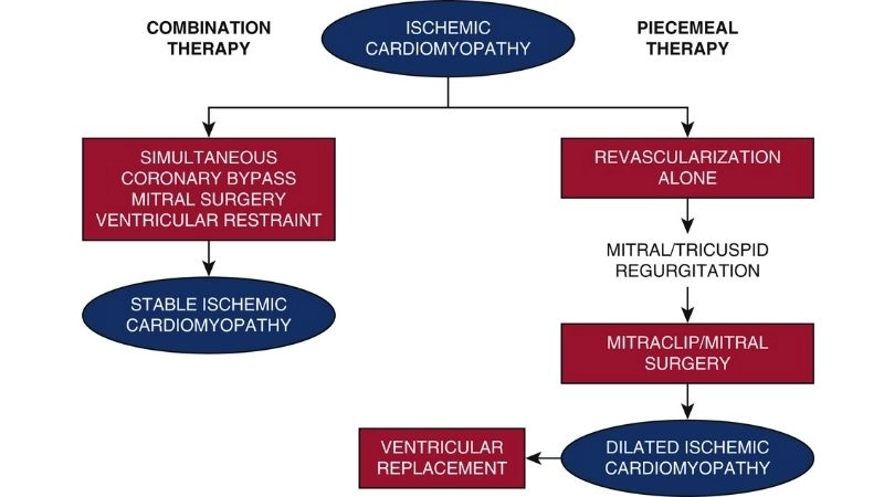 Revascularization for ischemic cardiomyopathy improves outcomes