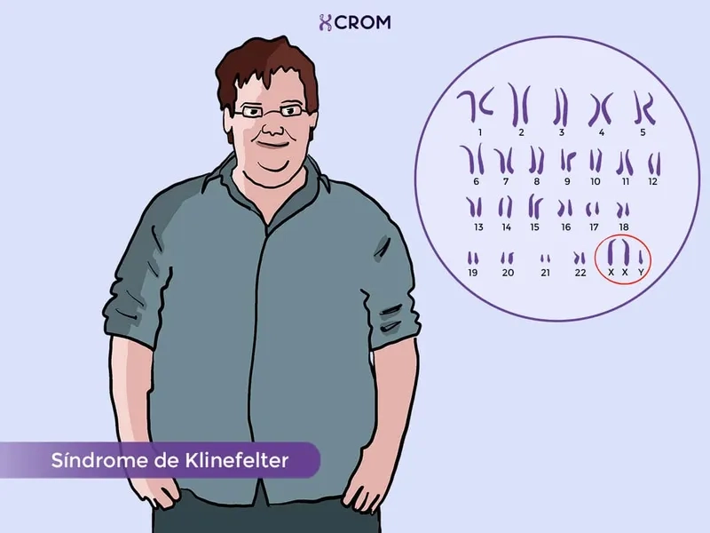 Klinefelter syndrome treatment and care options