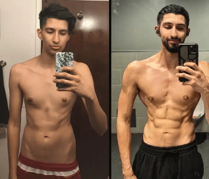 Klinefelter syndrome life expectancy and outlook