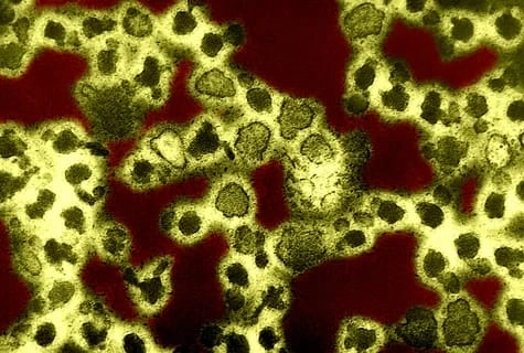 Understanding the long-term effects of La Crosse encephalitis