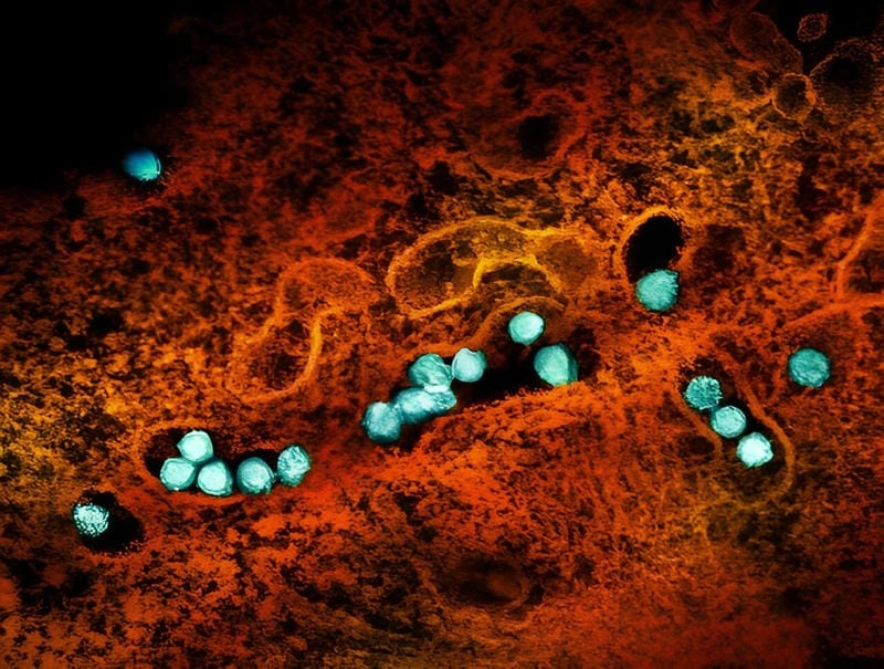 Young child showing La Crosse encephalitis symptoms